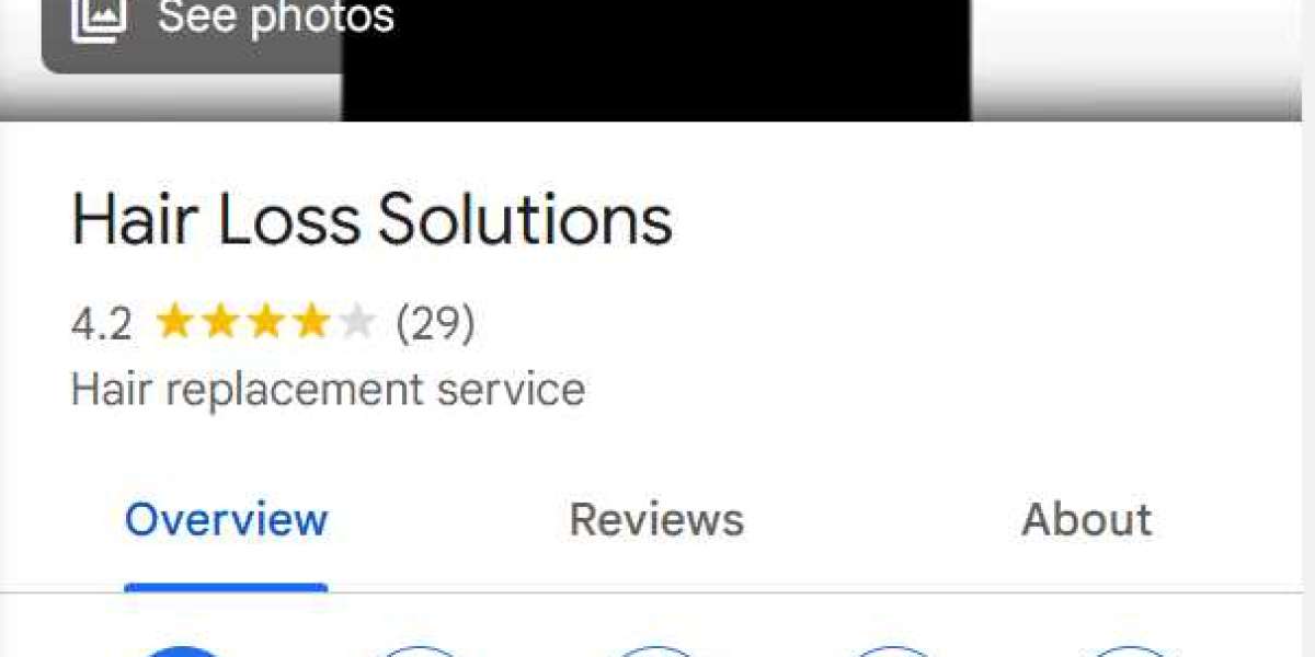 male hair implants clinic near me