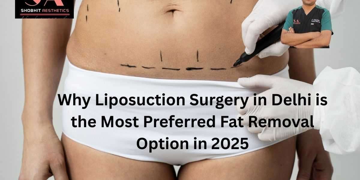 Why Liposuction Surgery in Delhi is the Most Preferred Fat Removal Option in 2025