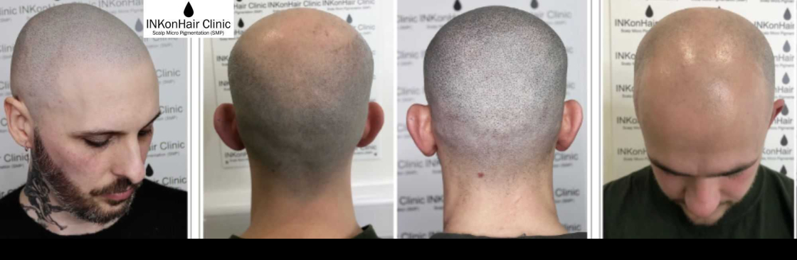 INKonHair Clinic Cover Image