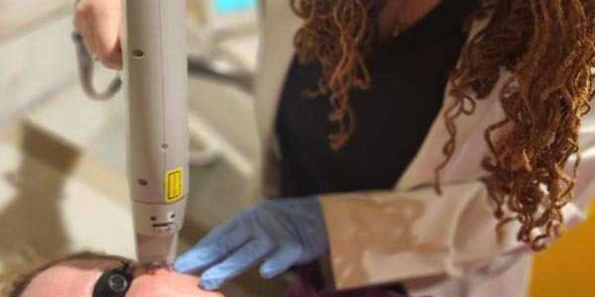 Laser Facial Treatment Clermont