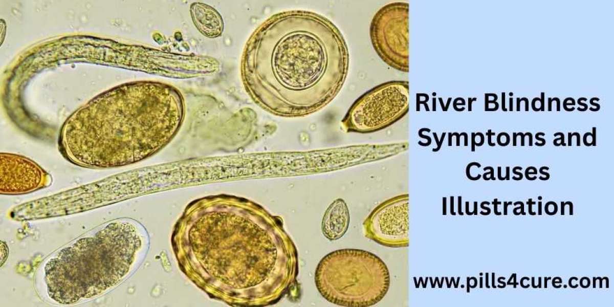 Living with River Blindness Disease: Tips and Medical Guidance