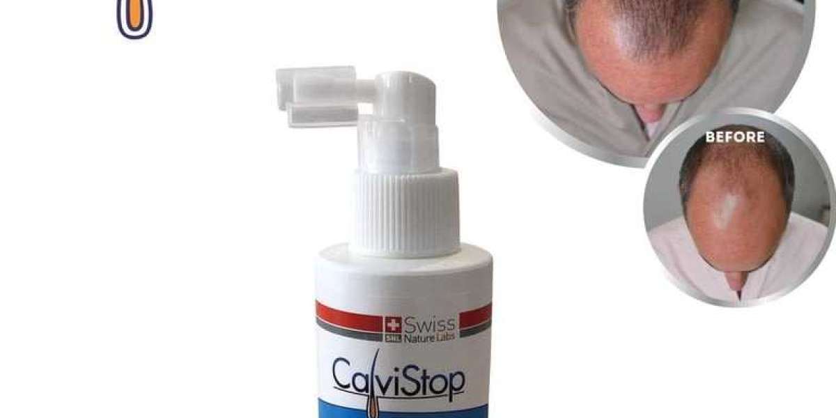 CalviStop Hair Loss Treatment Spray Price & Benefits – A Natural Solution for Thicker, Stronger Hair