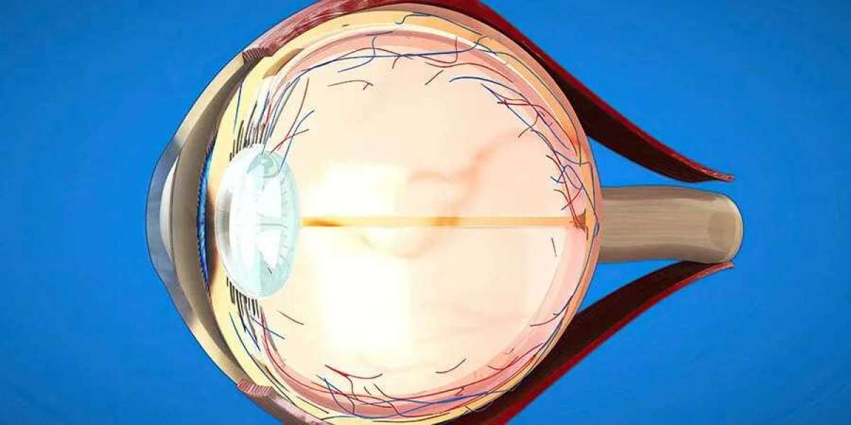 Seeing Flashes or Floaters? It Could Be a Sign You Need Retinal Detachment Treatment