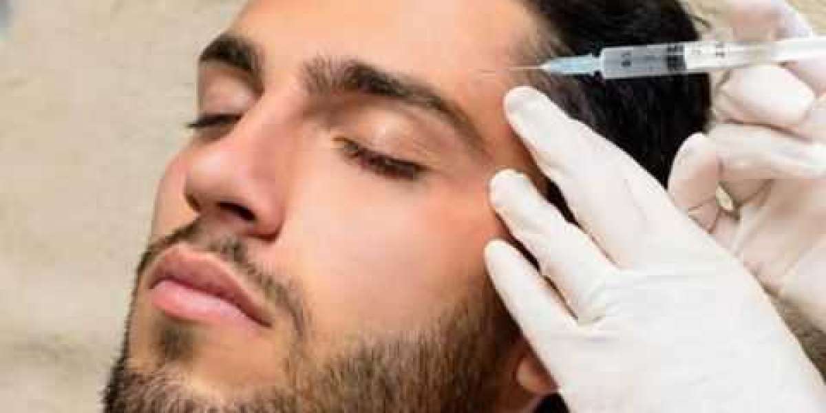 PRP Hair Therapy in Islamabad – Restoring Confidence with Natural Growth