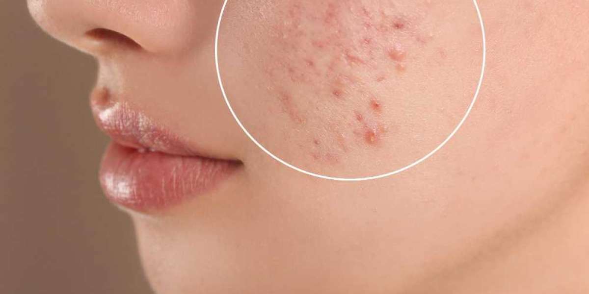 How to Choose Anti-Aging Treatments in Tyler, TX