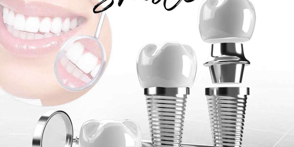 Comprehensive Dental Care in Hyderabad: Modern Treatments for a Healthy, Confident Smile
