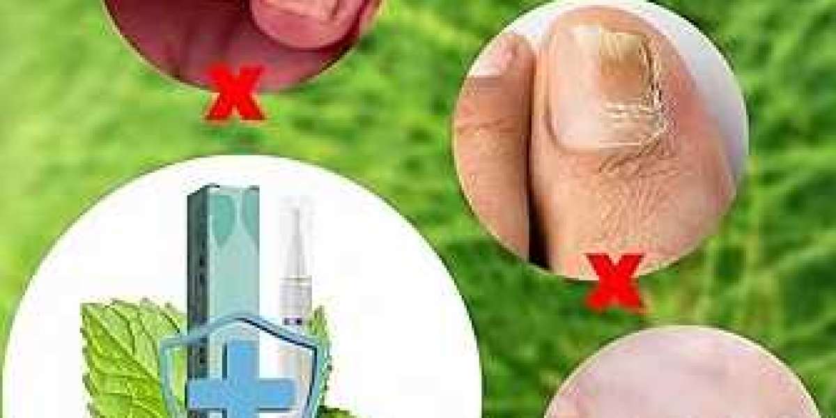 Orivelle Fungus Pen Review: Does This Nail Treatment Really Work?