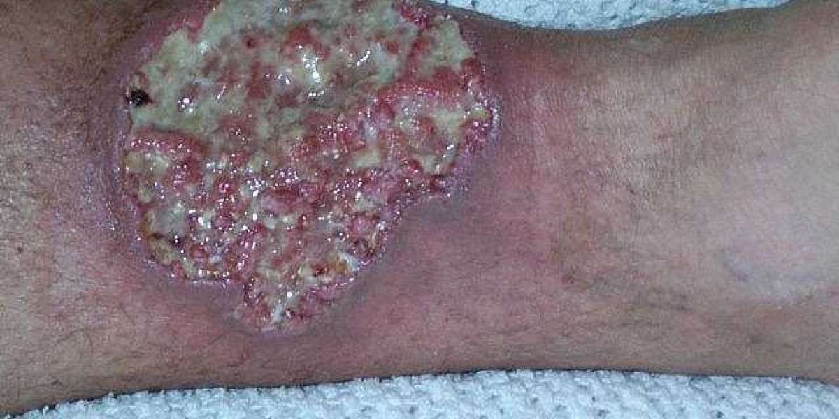 The Role of Nutrition in Managing Pyoderma