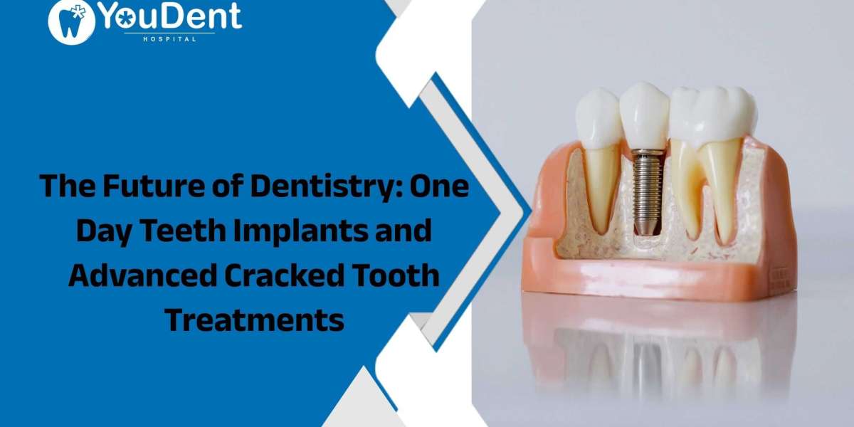 The Future of Dentistry: One Day Teeth Implants and Advanced Cracked Tooth Treatments