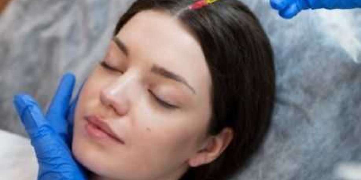 Why Many Are Choosing Eyebrow Hair Transplant: A Smart Move for Natural Brows