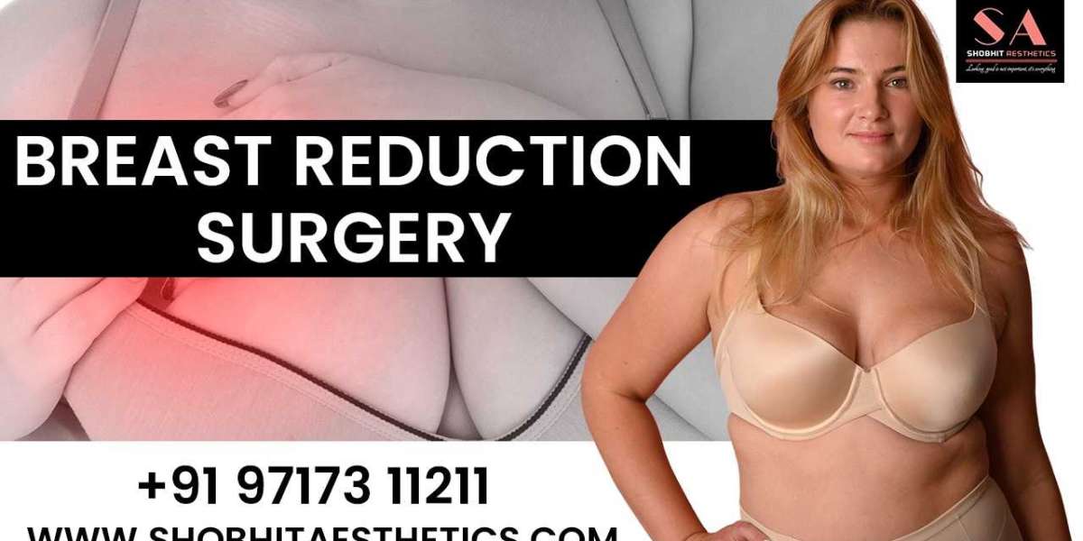 Breast Reduction Surgery in India: Cost and Best Doctor