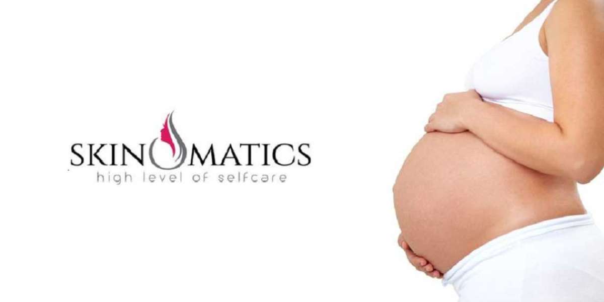 Best Oil Prevent Stretch Marks – Skinomatics