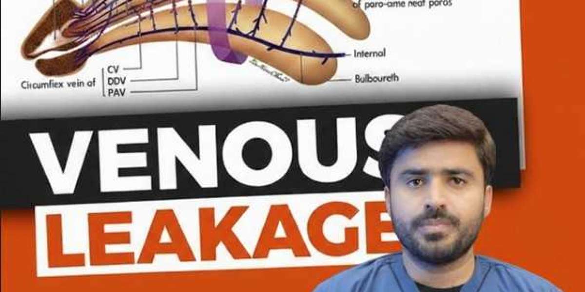 Venous Leak Treatment: Causes, Symptoms & Effective Treatment Options