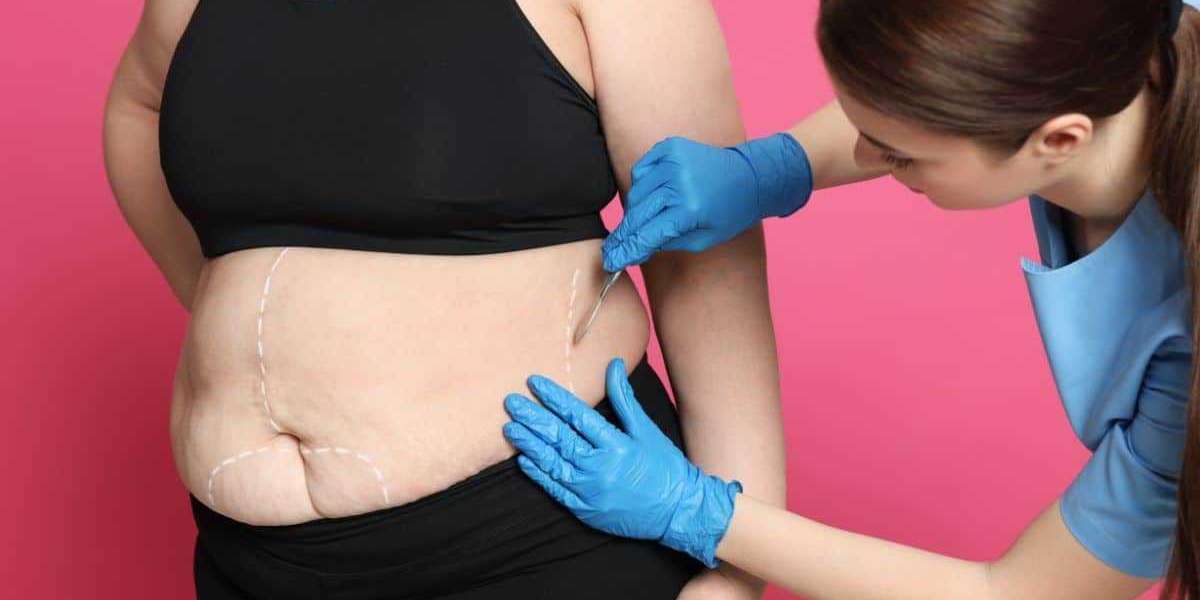 Bariatric Follow-Up Care in Islamabad Clinic