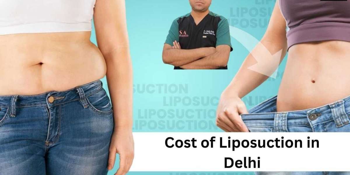 What Is the Real Cost of Liposuction in Delhi?