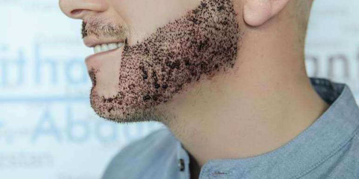 Beard Hair Transplant in Islamabad: Fast and Natural Results