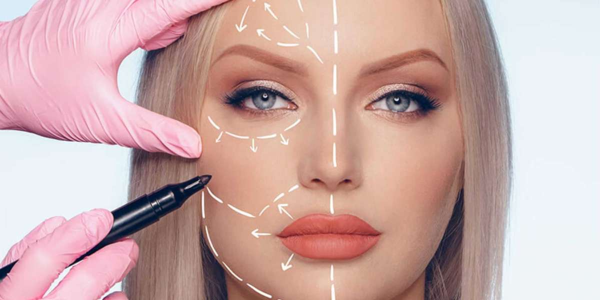 PDO vs PLA Thread Lift (2026 Guide): Which One Lasts Longer and Looks More Natural?