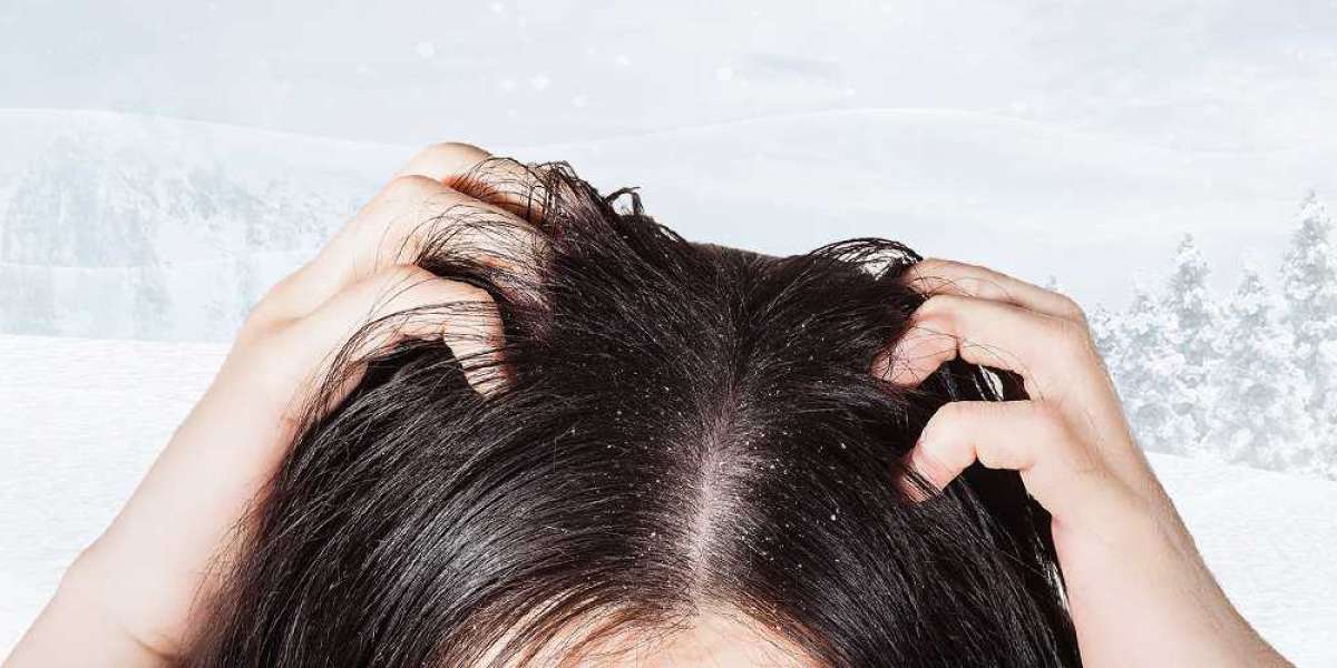 Winter Hair Care Mistakes to Avoid and Effective Hair Loss Treatment in Delhi at Derma Clinix