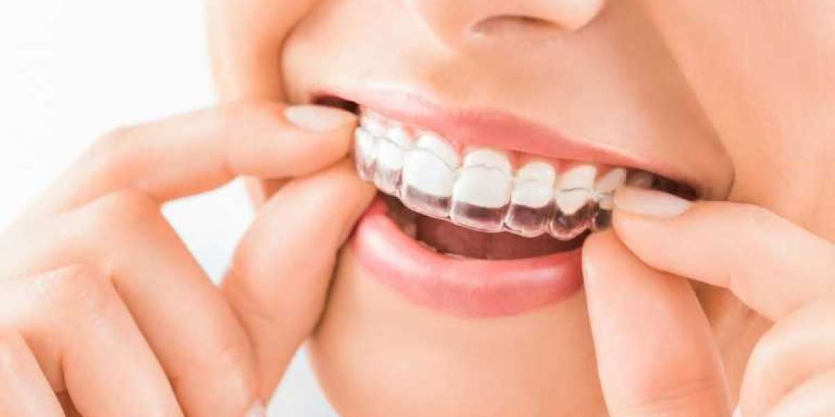 Invisalign Braces Dubai for Clear Teeth Alignment
