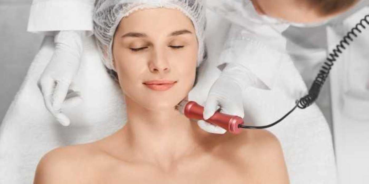 Safe and Effective Radiofrequency Skin Tightening for Long-Lasting Results