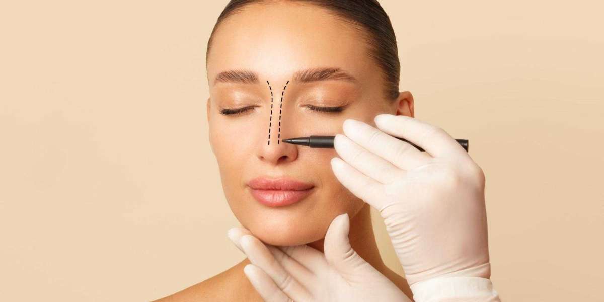 Planning Your Rhinoplasty Journey