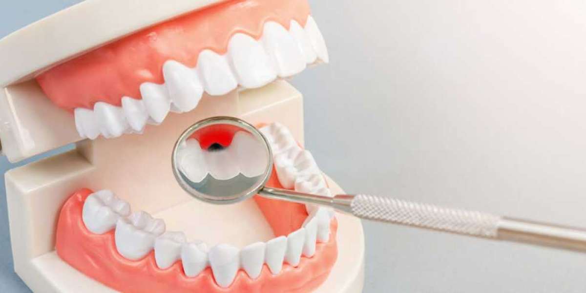 Expert Crowns in Converse, TX | Restore Your Smile with Kashi Dental