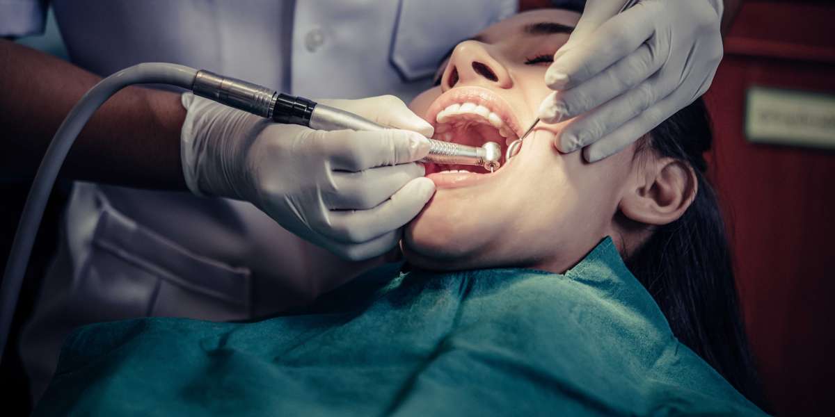 Best Dental Clinics in Bangalore: Choosing the Right Care for Your Smile