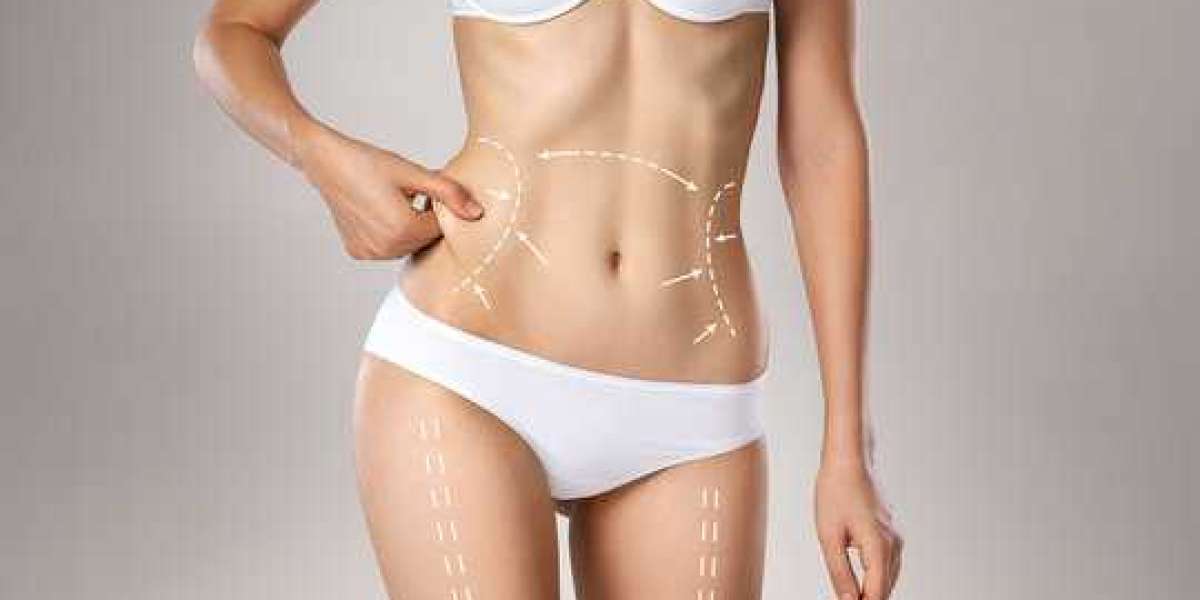 Look Your Best in Every Outfit with BodyTite Liposuction Riyadh