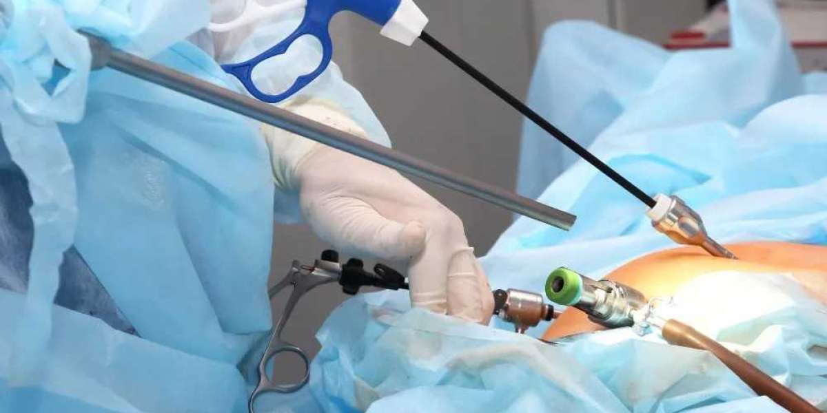 The Role of Anesthesia in Laparoscopic Surgery