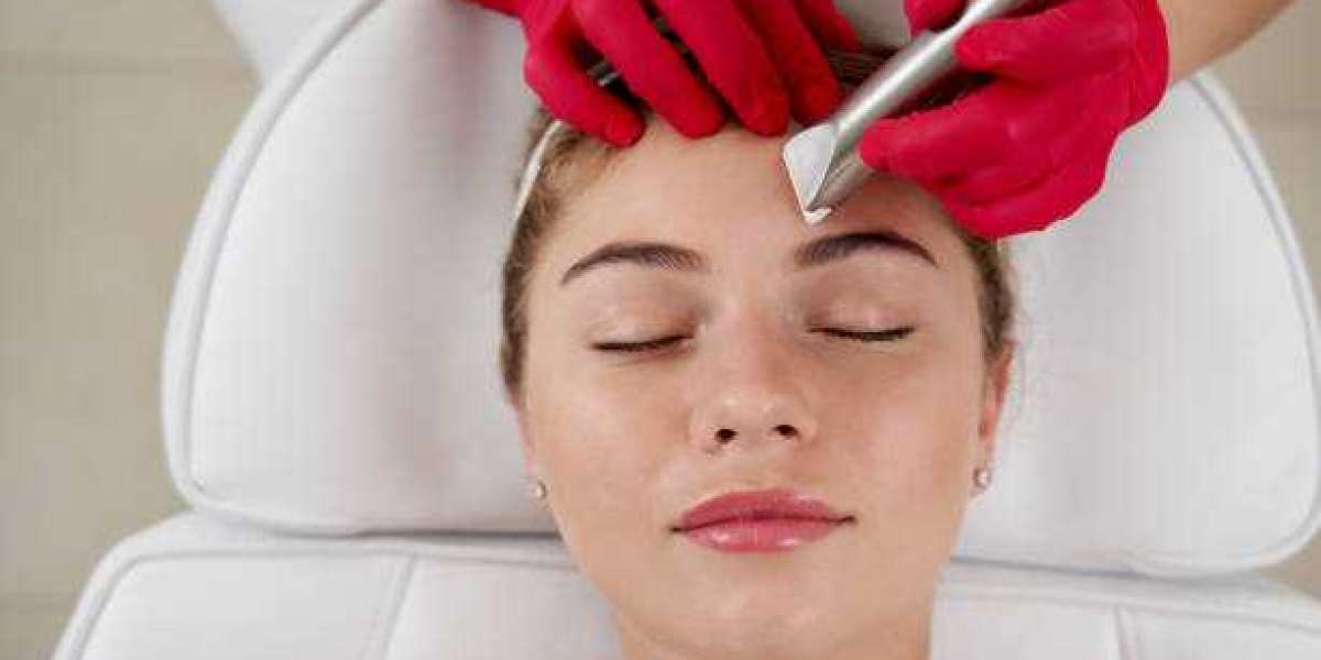 Electrolysis Hair Removal for Fine and Light Hair