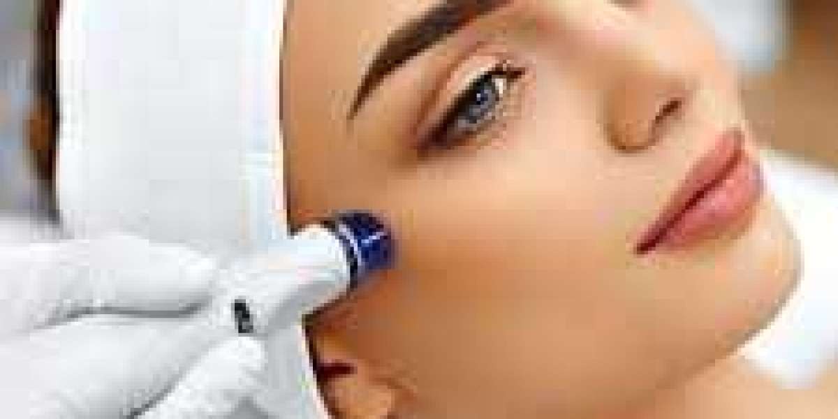 Hydrafacial Side Effects and Risks: What Islamabad Patients Should Know