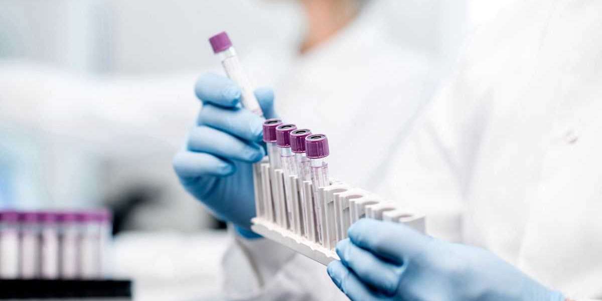 Enfield STD Clinic: STD Testing for Men’s Health