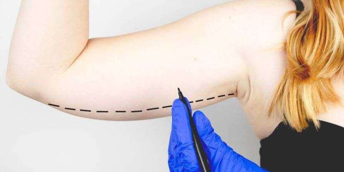 The Science of Scars: Advanced Techniques in Arm Lift Surgery in Riyadh