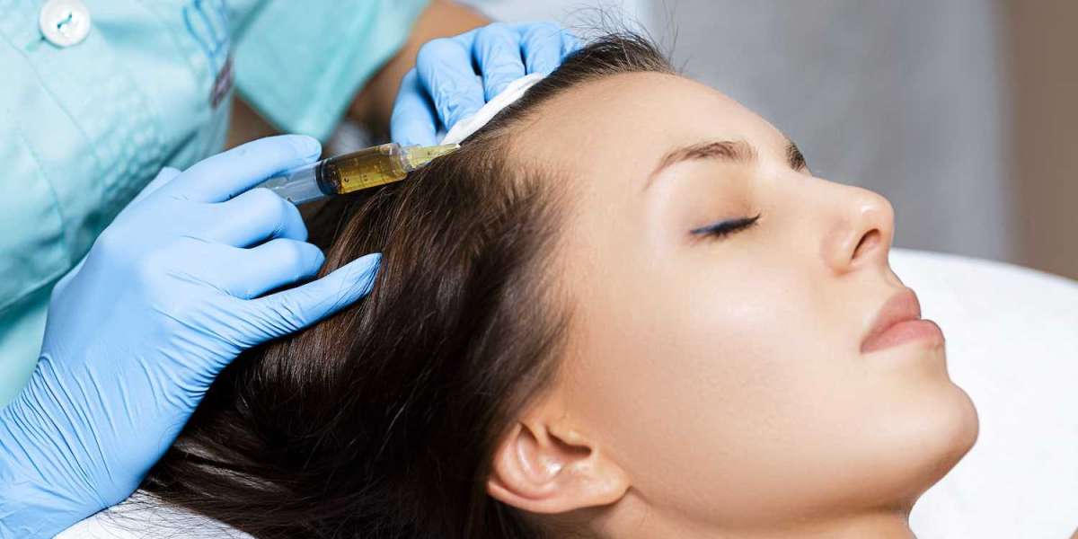 PRP Hair Treatment for Long-Term Hair Health and Maintenance