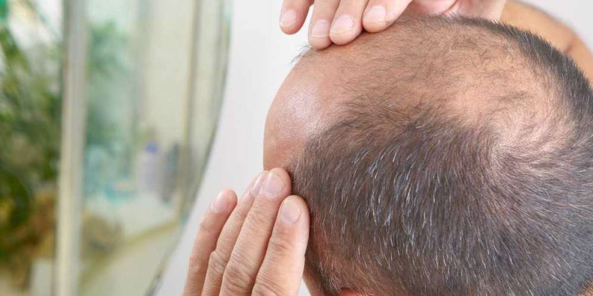 Is G Cell Treatment Worth It for Hair Restoration?