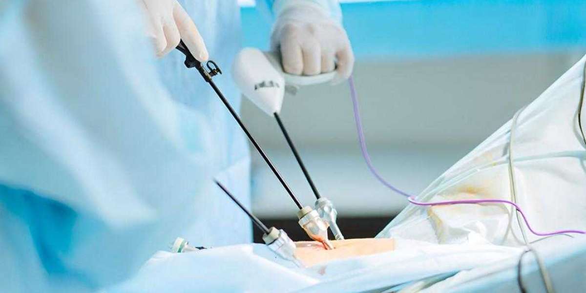 Advanced Healing Laparoscopic Surgery in Islamabad