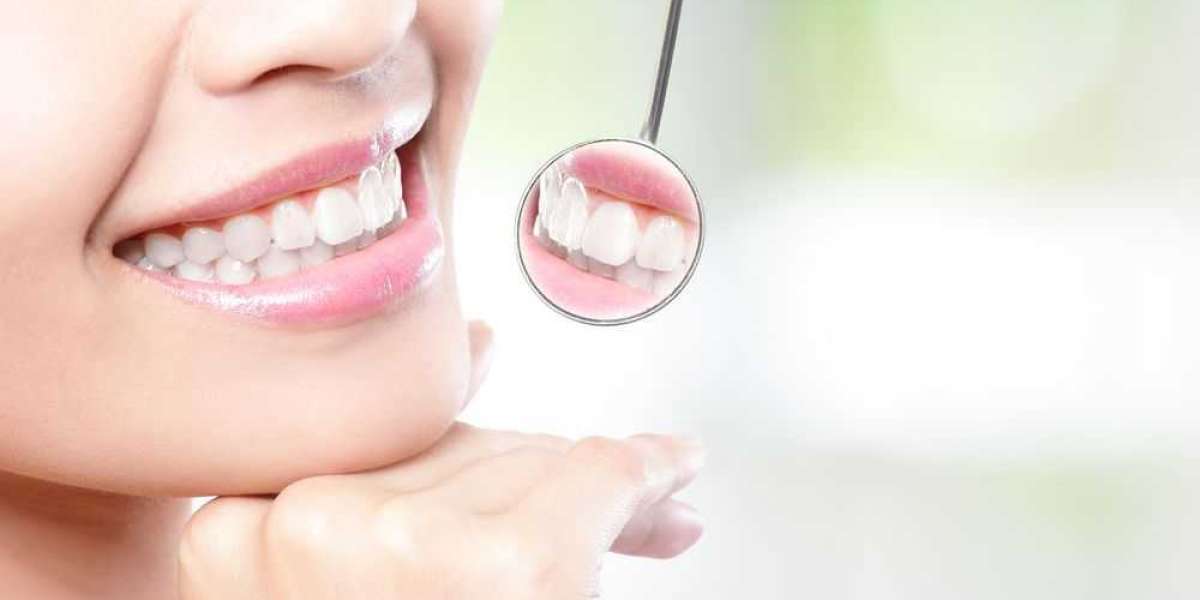 The Role of Nutrition in Maintaining Healthy Teeth