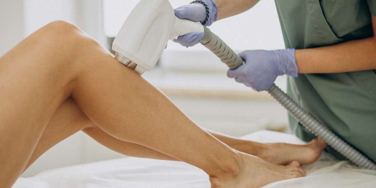 How to Maintain Results After Diode Laser Hair Removal Treatment