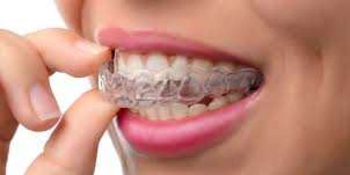 Teeth Aligners in Dubai for Discreet and Modern Orthodontic Care