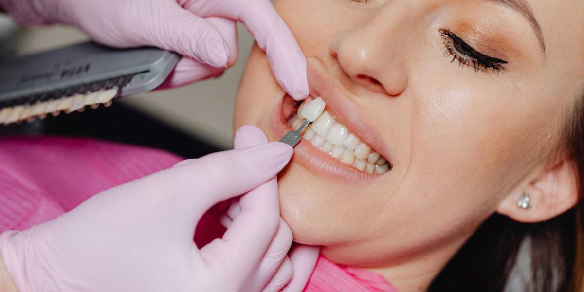 Best Dental Clinic In Ottawa For Implants, Cleaning & More