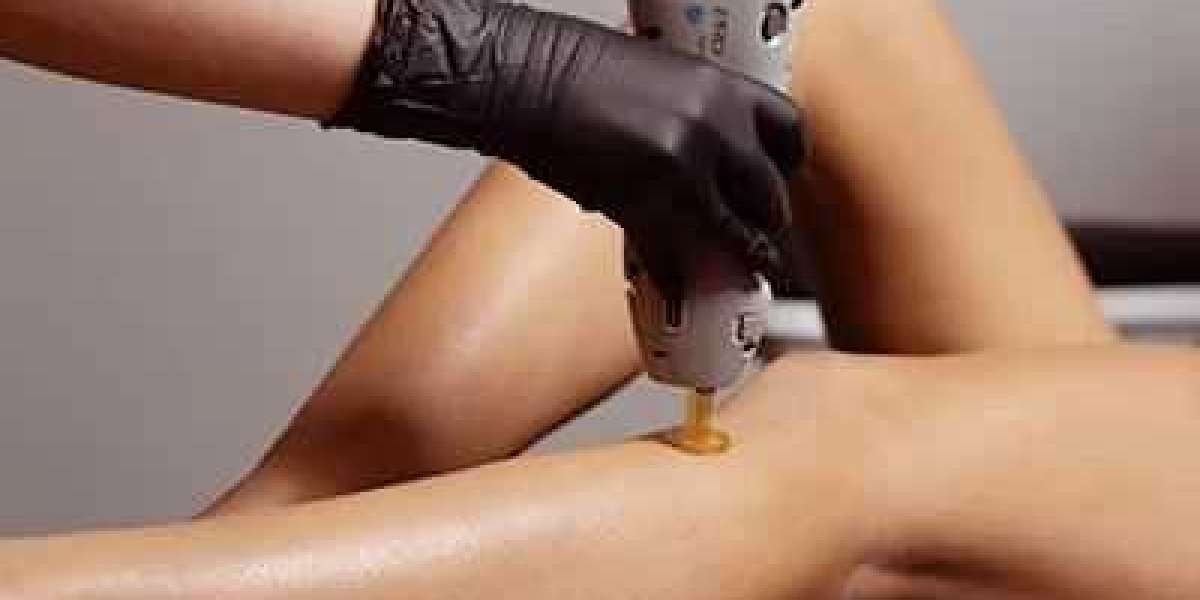 Laser Hair Removal: Royal Clinic Saudia’s Signature Treatment