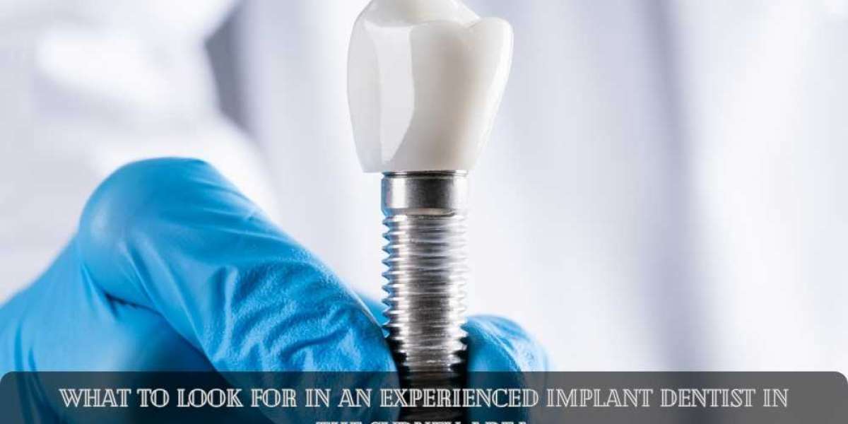 What to Look for in an Experienced Implant Dentist in the Sydney Area