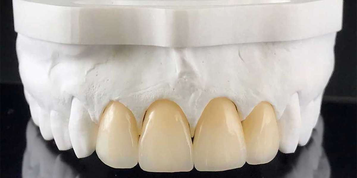 Zirconia Crown Dubai: Strong and Natural-Looking Dental Restoration