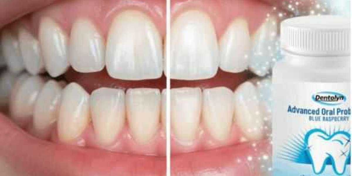 Dentolyn Capsules: Effective Oral Hygiene Booster for Strong Teeth & Healthy Gums!