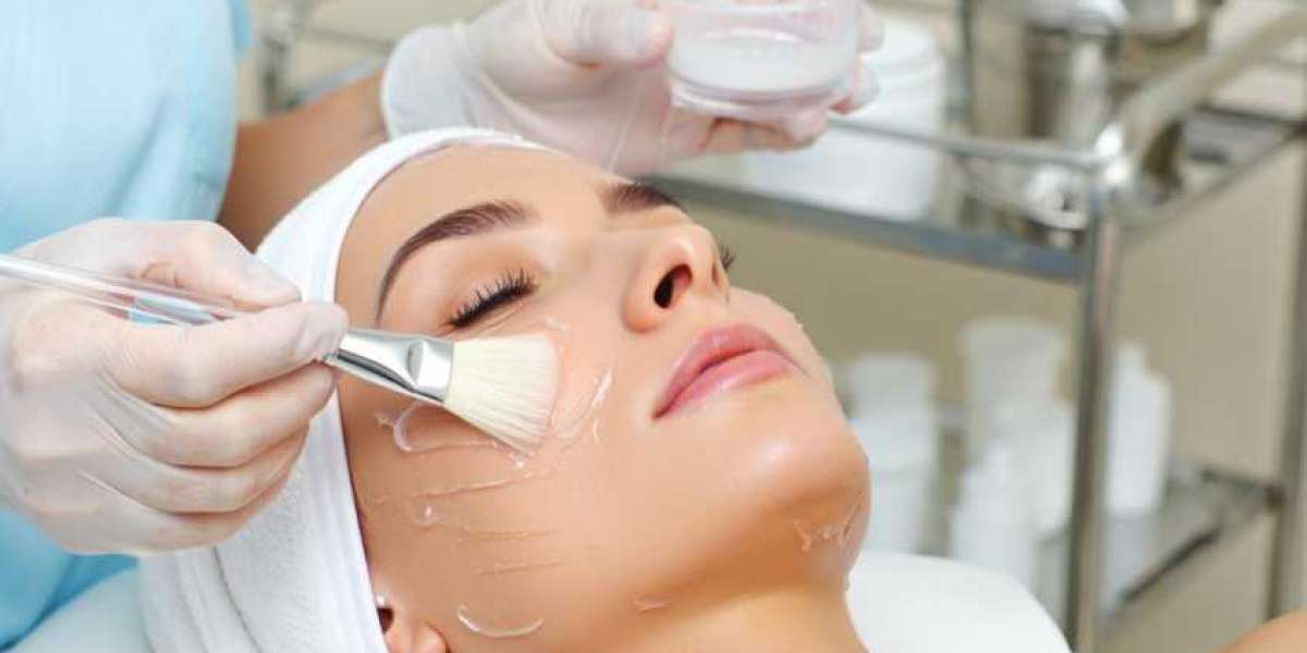 Are Chemical Peels Cost the Secret to Silky, Luminous, Healthy Skin