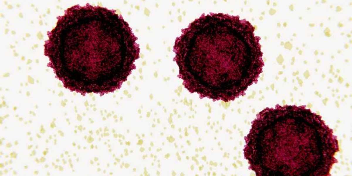 Calciphylaxis Market Size, Share, Trends & Analysis | 2035