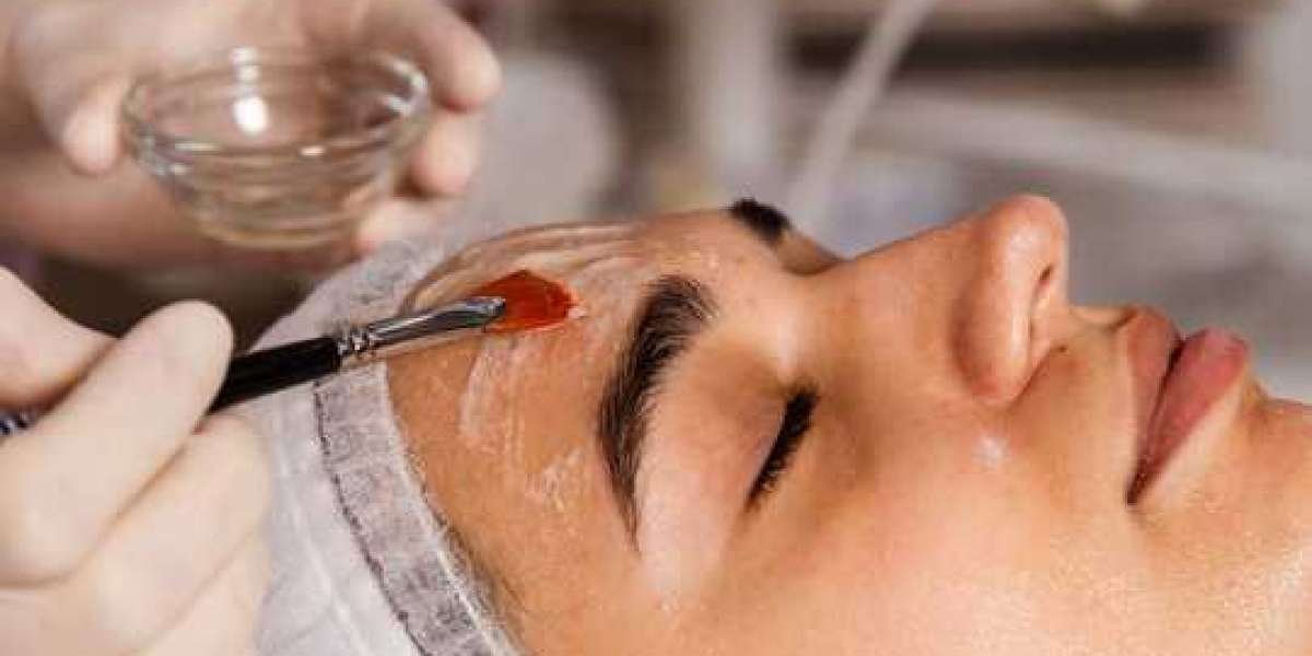 Best Chemical Peels in Islamabad for Glowing Skin