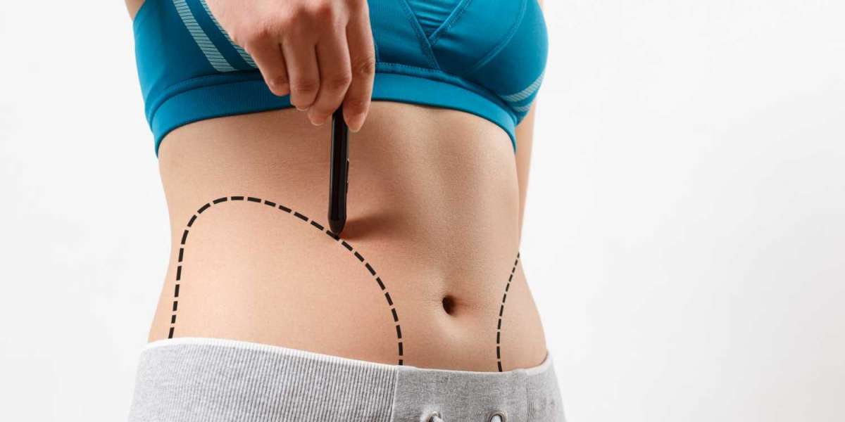 Best Vaser Liposuction Surgeon in Dubai for Customized Treatment Plans
