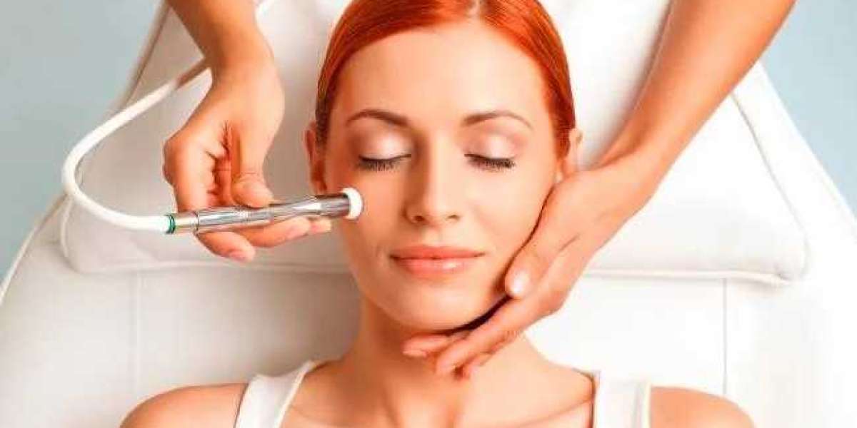 Benefits of Facial Microdermabrasion Treatment in Fort Lauderdale