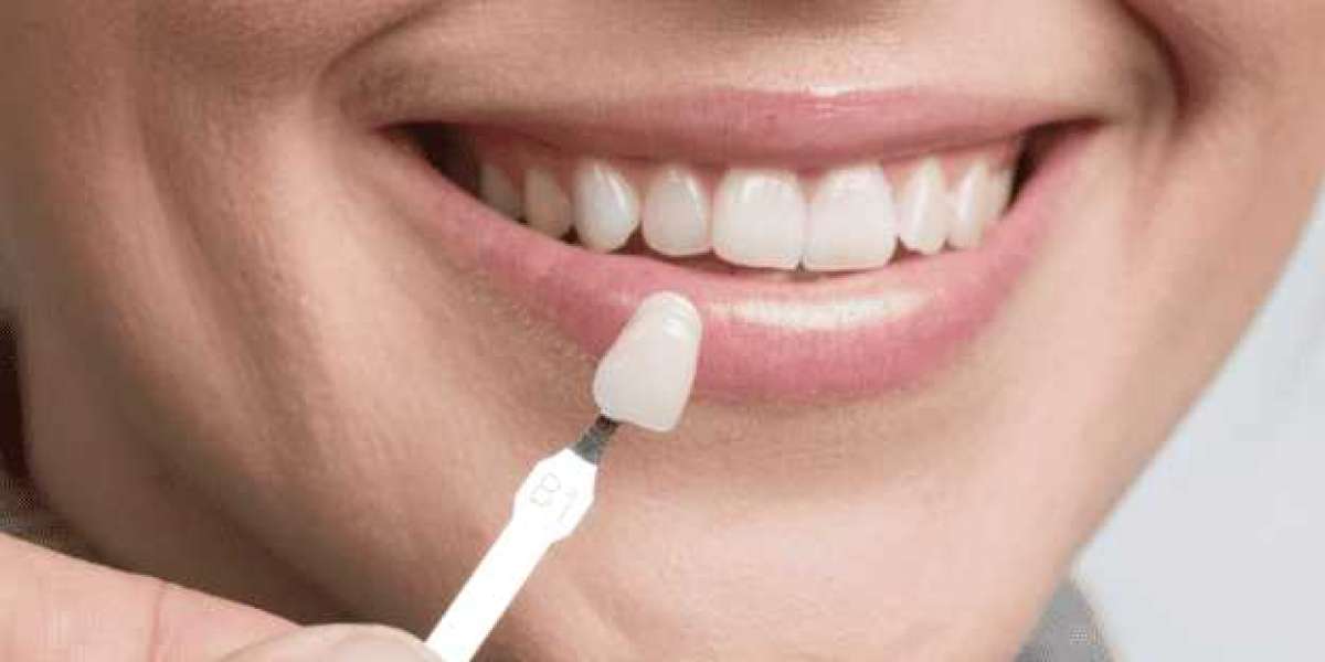 Cosmetic Dentist Dubai for Perfect Smile Care